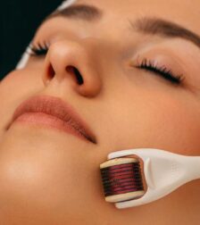 Kobieta poddawana zabiegowi derma rollerem na twarzy
